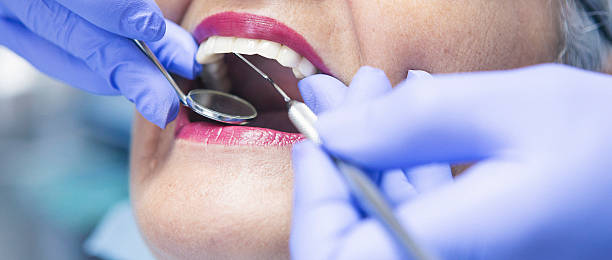 Best Emergency Root Canal Treatment in Rainier, OR